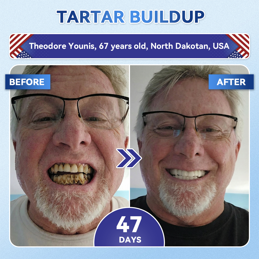 HZA®health 🦷 Tideglusib Fast‑Dissolving Tooth & Gum Repair Oral Strips ✨