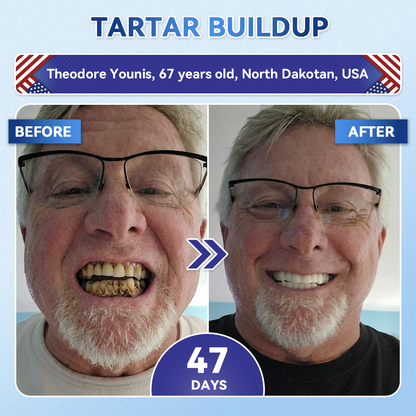 HZA®health 🦷 Tideglusib Fast‑Dissolving Tooth & Gum Repair Oral Strips ✨