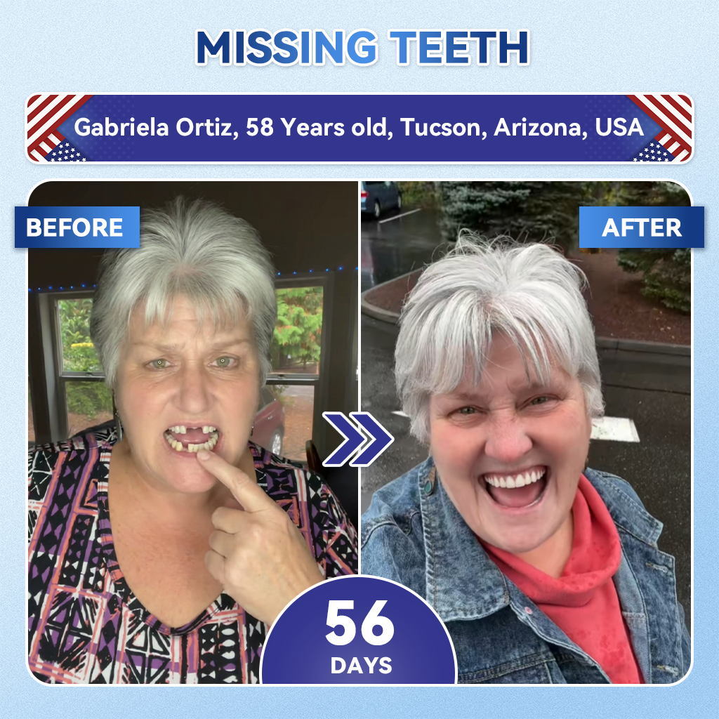 HZA®health 🦷 Tideglusib Fast‑Dissolving Tooth & Gum Repair Oral Strips ✨