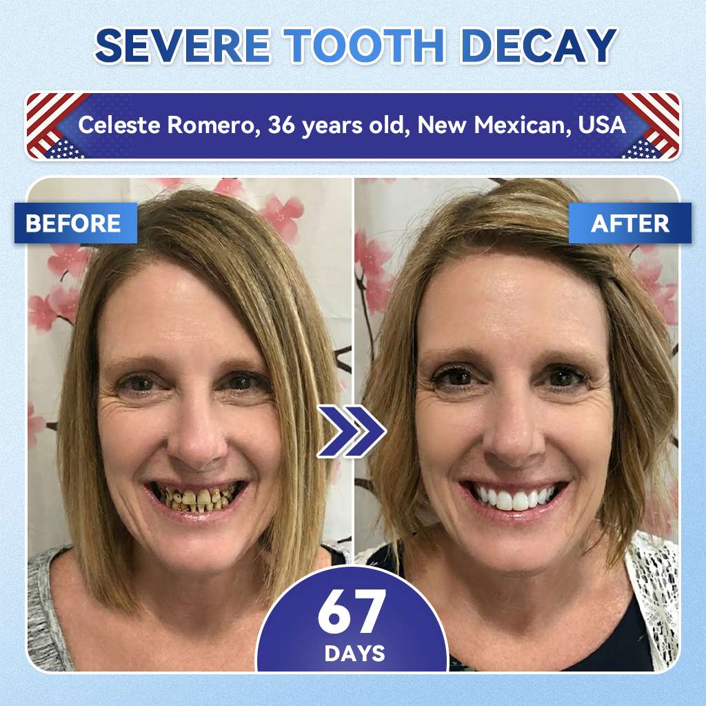HZA®health 🦷 Tideglusib Fast‑Dissolving Tooth & Gum Repair Oral Strips ✨